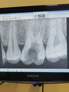 sriviga-dental-care-chennai-1v622-dentistdekho